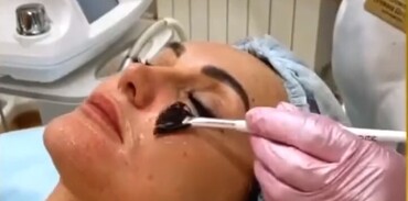 Комплексный уход 4в1 на аппарате PROFACIAL.